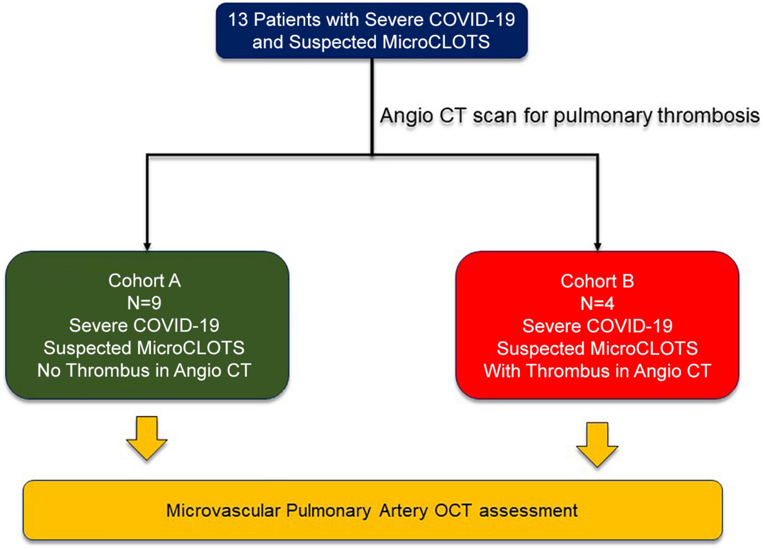 Microvascular lung vessels obstructive thromboinflammatory syndrome in patients with COVID-19: Insights from lung intravascular optical coherence tomography